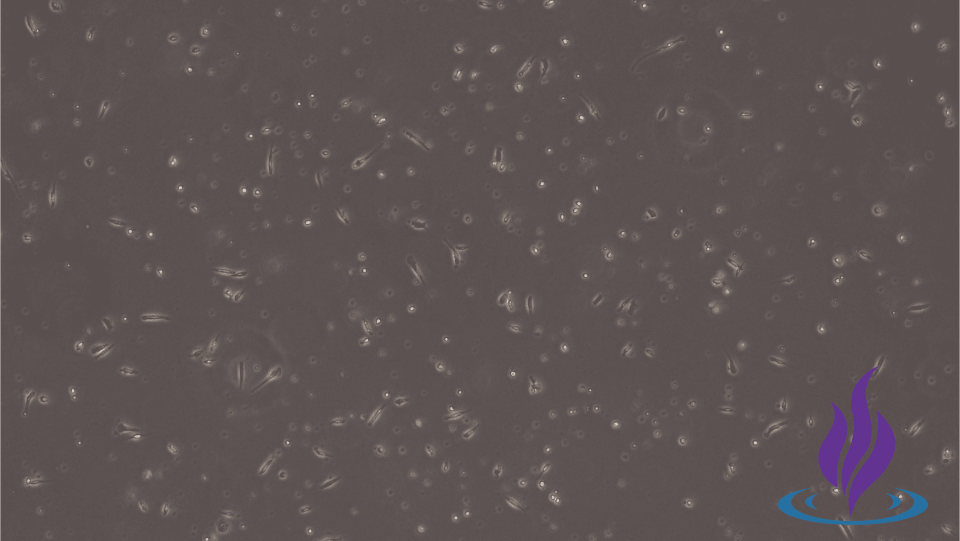 Hofbauer Cells (Macrophages)