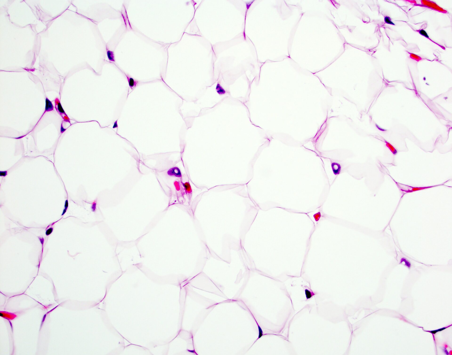 Human Adipocytes